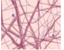 Connective Tissue